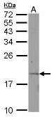 Anti-KRTAP11-1 antibody [N1C3] used in Western Blot (WB). GTX122177