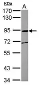 Anti-MPEG1 antibody [N1N3] used in Western Blot (WB). GTX122198