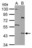 Anti-SLC25A46 antibody [N2C2], Internal used in Western Blot (WB). GTX122233