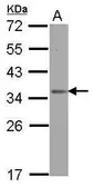 Anti-OTUD6B antibody used in Western Blot (WB). GTX122242