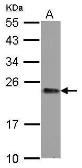 Anti-GNPNAT1 antibody [N1C3] used in Western Blot (WB). GTX122246