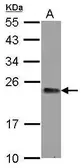 Anti-GNPNAT1 antibody [N1C3] used in Western Blot (WB). GTX122246