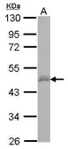 Anti-CERD4 antibody [N1C1] used in Western Blot (WB). GTX122249