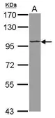 Anti-ST18 antibody [N1N2], N-term used in Western Blot (WB). GTX122254