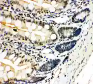 Anti-NFkB p100/p52 antibody used in IHC (Paraffin sections) (IHC-P). GTX12226
