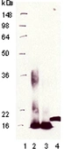 Anti-Metallothionein antibody [UC1MT] used in Western Blot (WB). GTX12228