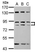 Anti-ZFY antibody [N1N2], N-term used in Western Blot (WB). GTX122296