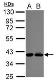 Anti-POLDIP3 antibody [N2C3] used in Western Blot (WB). GTX122304