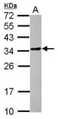 Anti-POMZP3 antibody [N1C3] used in Western Blot (WB). GTX122308