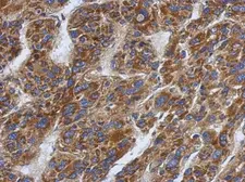 Anti-SFXN1 antibody used in IHC (Paraffin sections) (IHC-P). GTX122365