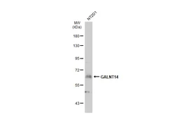 Anti-GALNT14 antibody [N1N3] used in Western Blot (WB). GTX122371