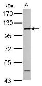 Anti-CTAGE1 antibody [N3C2], Internal used in Western Blot (WB). GTX122445