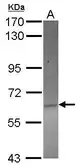 Anti-ACOT12 antibody [C1C3] used in Western Blot (WB). GTX122449