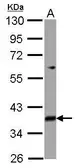 Anti-MRPL39 antibody [N1C1] used in Western Blot (WB). GTX122461