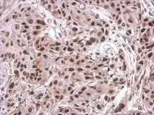 Anti-NIP30 antibody used in IHC (Paraffin sections) (IHC-P). GTX122479