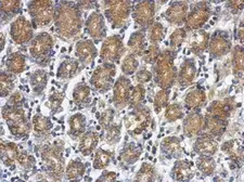 Anti-RUNDC1 antibody used in IHC (Paraffin sections) (IHC-P). GTX122487