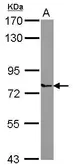 Anti-PARP6 antibody used in Western Blot (WB). GTX122488