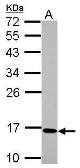 Anti-C17orf49 antibody used in Western Blot (WB). GTX122496