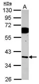 Anti-SDF4 antibody used in Western Blot (WB). GTX122508