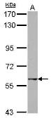 Anti-GTPBP2 antibody used in Western Blot (WB). GTX122509