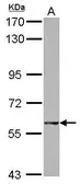 Anti-GTPBP2 antibody used in Western Blot (WB). GTX122509