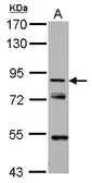 Anti-KBTBD3 antibody used in Western Blot (WB). GTX122513