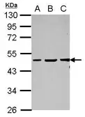 Anti-Vasculin antibody [N1N3] used in Western Blot (WB). GTX122517