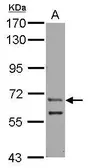 Anti-ZFY antibody [C1C3] used in Western Blot (WB). GTX122542