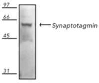 Anti-Synaptotagmin antibody [ASV48] used in Western Blot (WB). GTX12255