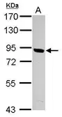 Anti-PNPLA8 antibody used in Western Blot (WB). GTX122550