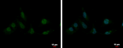 Anti-SAP130 antibody [N1N2], N-term used in Immunocytochemistry/ Immunofluorescence (ICC/IF). GTX122554