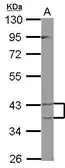Anti-PECI antibody used in Western Blot (WB). GTX122557