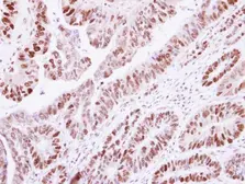 Anti-Histone H1.2 antibody used in IHC (Paraffin sections) (IHC-P). GTX122561