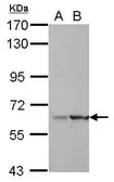 Anti-LRWD1 antibody [C2C3], C-term used in Western Blot (WB). GTX122562
