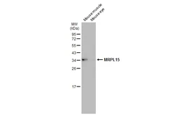 Anti-MRPL15 antibody used in Western Blot (WB). GTX122571