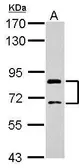 Anti-SLCO1C1 antibody used in Western Blot (WB). GTX122603