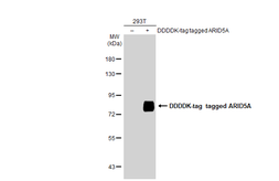 Anti-ARID5A antibody used in Western Blot (WB). GTX122605
