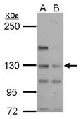 Anti-TTLL4 antibody [N3C1], Internal used in Western Blot (WB). GTX122610