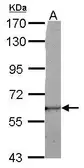 Anti-LRRC50 antibody used in Western Blot (WB). GTX122620