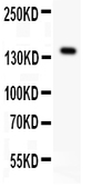 Anti-VEGF Receptor 1 antibody used in Western Blot (WB). GTX12263
