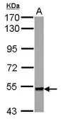 Anti-Plexin A4 antibody [N1], N-term used in Western Blot (WB). GTX122632