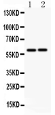 Anti-LTBR antibody used in Western Blot (WB). GTX12264