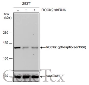 Anti-ROCK2 (phospho Ser1366) antibody used in Western Blot (WB). GTX122651