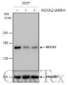 Anti-ROCK2 antibody used in Western Blot (WB). GTX122652