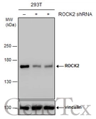 Anti-ROCK2 antibody used in Western Blot (WB). GTX122652