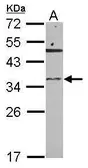Anti-Ribonuclease T2 antibody [N1C3] used in Western Blot (WB). GTX122679