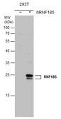 Anti-RNF185 antibody [N1C3] used in Western Blot (WB). GTX122691