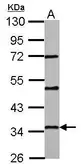 Anti-PAQR6 antibody used in Western Blot (WB). GTX122692
