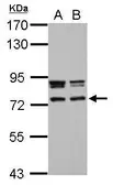 Anti-CCDC151 antibody used in Western Blot (WB). GTX122743