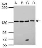 Anti-LARS antibody [C2C3], C-term used in Western Blot (WB). GTX122744